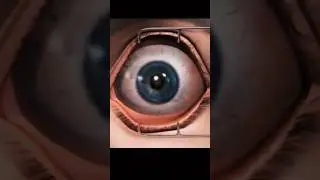 निकट दृष्टिदोष कैसे होता हैं - Myopia #facts  #eyes