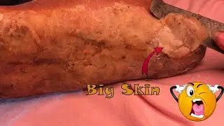 How to removal skin | callus removal skin flakes #30