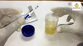 How to perform HCG Pregnancy test at home
