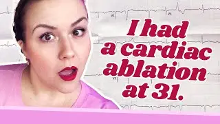 My Cardiac Ablation | SO I HAD (minor) HEART SURGERY