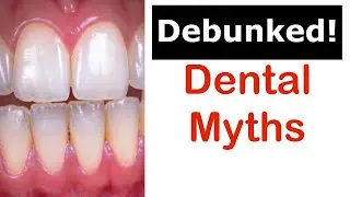 Dental Myths Debunked!