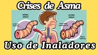 Primeiros Socorros Para CRISE de ASMA: Uso de Inalador e Medida Emergencial