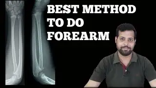 HOW TO DO X-RAY OF FOREARM || 