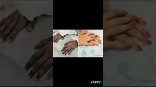 She received male hands 