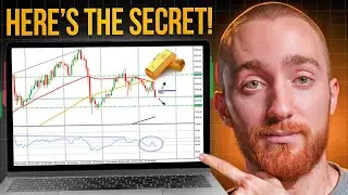 Why Traders SUCK At Trading XAUUSD