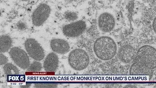 University of Maryland reports first presumptive case of monkeypox | FOX 5 DC