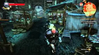 Witcher 3 - Hair Bug (sign)