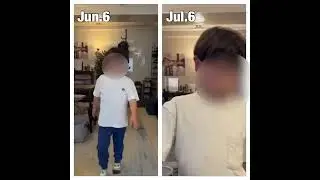 Duchenne muscular dystrophy improvement record