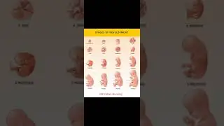 Stage of fetus Development, ovum, zygote, embryo, fetal, new born, neonates 