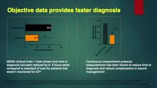 Dr. Ross Leighton MEMS Technology