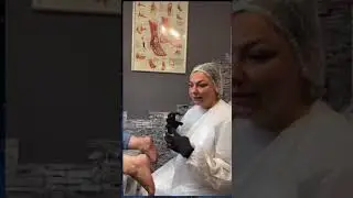 010 Гиперкератоз Раскрытие трещин колпачками и дисками Перевязка Подомарафон