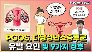 다낭성난소증후군(PCOS)의 4가지 요인과 9가지 징후