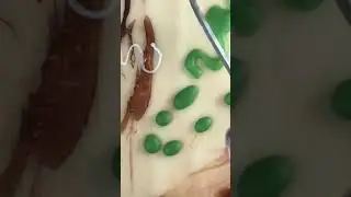 Removing Unwanted Wax from Encaustic Surfaces