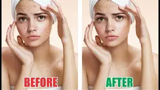 HOW TO REMOVE RED SPOTS ON FACE IN COREL PHOTOPAINT