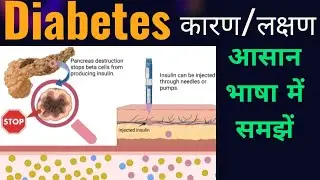 What is Diabetes? 🤔#in hindi