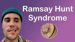 How Ramsay Hunt Syndrome Can Cause Hearing Loss & Other Symptoms | Treatment Options