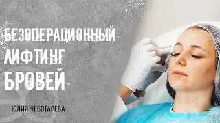👁 Лифтинг бровей без операции: уникальное сочетание трех технологий. Лифтинг бровей без операции.12+
