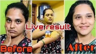 My Weekend Pampering Routine Vlog💆‍♀️| Amazing Live Results 🔴 #vlog #saranstyle