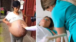 Woman With Giant Belly Shocked When Doctor’s Realize What’s Growing Inside Of Her!