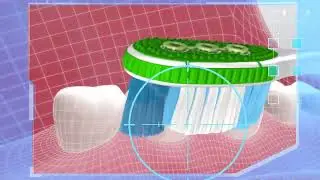 Colgate 360 Surround