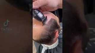 Установка системы волос. Мужские парики.