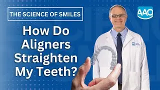 How Do Aligners Straighten my Teeth?