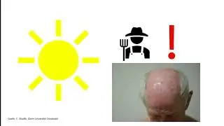 Berufsdermatologie Teil 5: Beruflicher Hautkrebs BK 5103