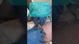 ВСЕМ РОДИТЕЛЯМ НОВОРОЖДЕННЫХ СМОТРЕТЬ ОБЯЗАТЕЛЬНО! ОСМОТР МЛАДЕНЦА ДЕТСКИМ УРОЛОГОМ 