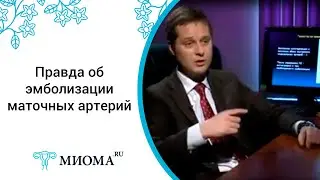 Мифы об эмболизации миомы