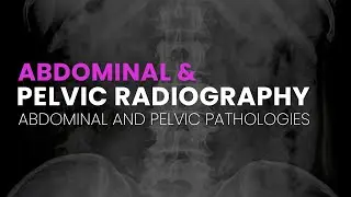 Abdominal and Pelvic Radiography | Abdominal and Pelvic Pathologies