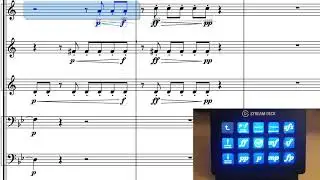 Notation Express for Sibelius - Dynamics