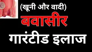 जड़ से समाप्त होगी बवासीर की समस्या | Piles treatment | Ayurvedic treatment for Piles