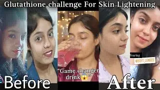 Skin Whitening challenge😱with glutathione|truth about glutathione