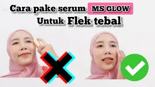 INI CARA AKU PAKAI SERUM  MS GLOW UNTUK FLEK TEBAL
