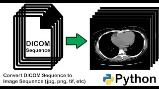How to Convert a DICOM file into an Image (jpg, png, tif, etc) using Python | Sequence DICOM Files |