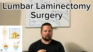 My journey with spinal stenosis and back surgery
