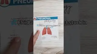 🫁 Pathophysiology of Pneumonia (Visual Breakdown!)