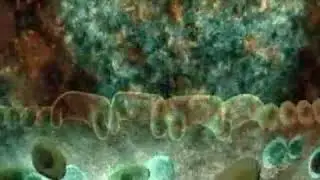 The Acquired Immune System