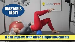 How to improve Diastasis Recti with a few simple exercises!
