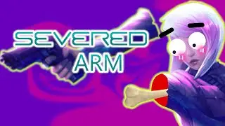 Severed Ar-  I mean Steel