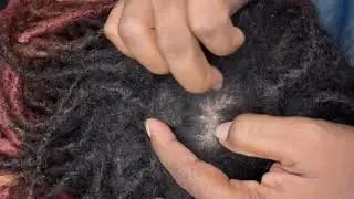 ASMR scalp scratching sweet birds sound