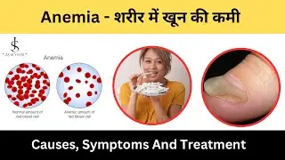 Anemia symptoms causes and diet in Hindi
