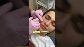 3 мифа о ботоксе! Всё ошибаются! 