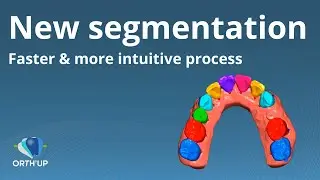 Segmentation | ORTH'UP clear aligners CAD software