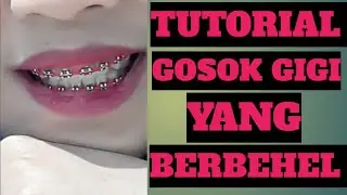 TUTORIAL GOSOK GIGI YANG BERBEHEL (KAWAT GIGI)