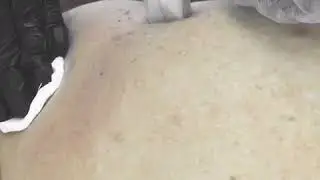 Насадка Fractora