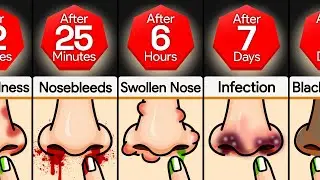Timeline: What If You Never Stopped Picking Your Nose?