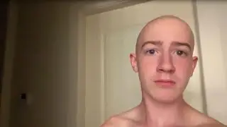 Going Bald