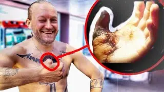 JARPPI'S THE WORST ACCIDENT! (Dudesons)
