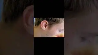 EWWWWW! (Expert Earwax Removal) - Dr. Paul (Retired)